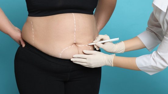 Com estratégia técnica, Saúde de São Vicente supera cotas do Estado para cirurgia bariátrica - Imagem: Reprodução
