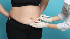Com estratégia técnica, Saúde de São Vicente supera cotas do Estado para cirurgia bariátrica - Imagem: Reprodução