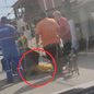 Alessandro Gonçalves, gari de 32 anos, foi atingido por uma moto enquanto trabalhava, resultando em fratura no maxilar - Imagem: Reprodução