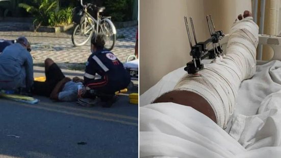Ex-primeira-dama de Bertioga foi condenada após atropelar ciclista na calçada e deixar o local sem prestar socorro. - Imagem: Arquivo Pessoal