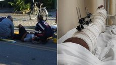 Ex-primeira-dama de Bertioga foi condenada após atropelar ciclista na calçada e deixar o local sem prestar socorro. - Imagem: Arquivo Pessoal