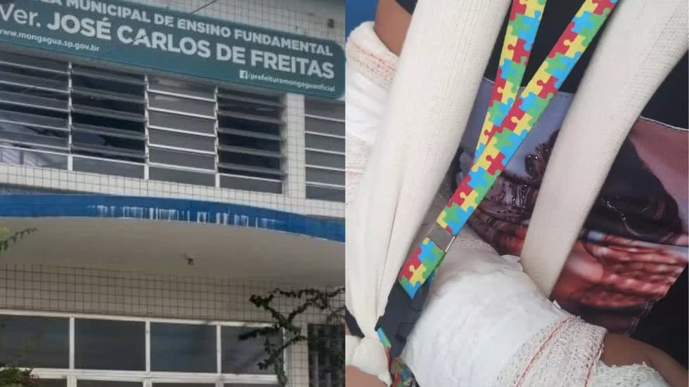Uma adolescente de 12 anos com Transtorno do Espectro Autista foi agredida por colegas na Escola Municipal Vereador José Carlos de Freitas, em Mongaguá - Imagem: Reprodução