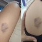 Estudante de 11 anos relatou ter sido agredida por um colega dentro de uma sala de aula em escola municipal de Praia Grande; caso é apurado pela Polícia Civil e também será analisado pelo conselho escolar - Imagem: Arquivo Pessoal