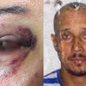 A polícia foi chamada por uma vizinha e prendeu o agressor em flagrante, que já tinha histórico de violência contra mulheres - Imagem: Arquivo Pessoal/ Reprodução