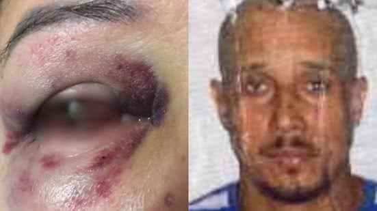 A polícia foi chamada por uma vizinha e prendeu o agressor em flagrante, que já tinha histórico de violência contra mulheres - Imagem: Arquivo Pessoal/ Reprodução