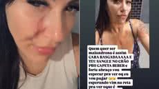 Caso foi registrado na Central de Polícia Judiciária de Praia Grande e é investigado como tentativa de homicídio. - Imagem: Arquivo pessoal