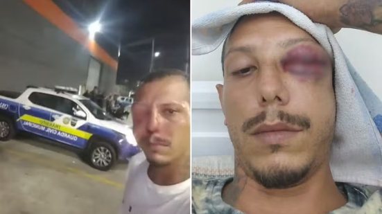 Homem ficou ferido após confusão com funcionários dentro de mercado em Praia Grande; caso foi registrado como lesão corporal e segue em investigação - Imagem: Arquivo Pessoal