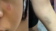 Briga familiar acaba em agressão brutal: jovem é atacada pela prima próxima à escola em São Vicente - Imagem: Reprodução/ g1
