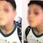 Estudante foi agredido com um soco no rosto por um colega ao sair da Escola Municipal Antônio Peres Ferreira - Imagem: Reprodução/Arquivo Pessoala/g1