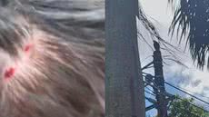 Rafael Martinez levou um susto ao ser atingido na cabeça por um gavião, que deixou cortes superficiais e gerou preocupação na família - Foto: Arquivo pessoal/ Reprodução