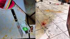 Homem foi socorrido, mas não resistiu aos ferimentos e morreu na UPA; polícia investiga o caso - Foto: Polícia Militar/ Divulgação