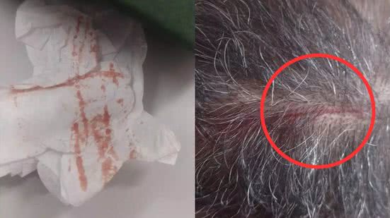 Casos de ataques de gaviões em Santos se tornam frequentes, com moradores exigindo respostas das autoridades locais - Imagem: Reprodução