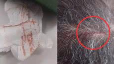 Casos de ataques de gaviões em Santos se tornam frequentes, com moradores exigindo respostas das autoridades locais - Imagem: Reprodução