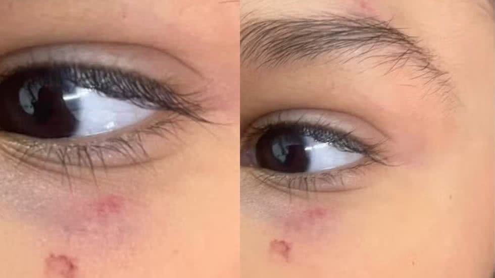 A Prefeitura de Praia Grande investiga o caso e promete tomar medidas se a agressão for confirmada - Imagem: Reprodução