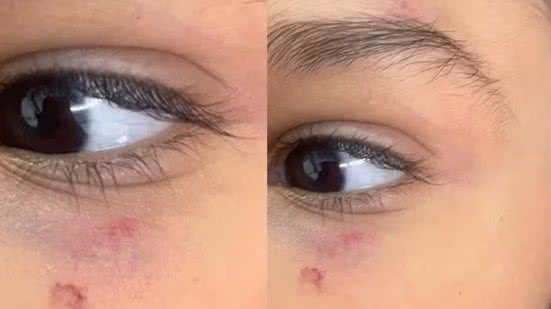 A Prefeitura de Praia Grande investiga o caso e promete tomar medidas se a agressão for confirmada - Imagem: Reprodução