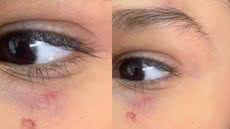 A Prefeitura de Praia Grande investiga o caso e promete tomar medidas se a agressão for confirmada - Imagem: Reprodução