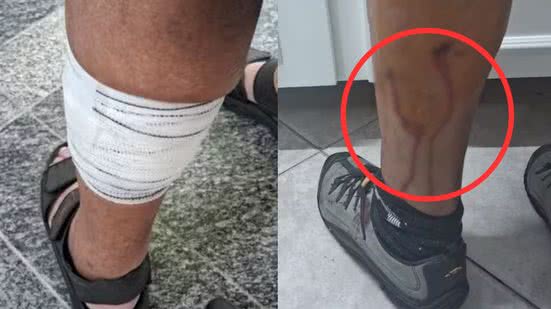 O ataque ocorreu em um local movimentado, levantando questões sobre a segurança de ciclistas e pedestres - Imagem: Reprodução