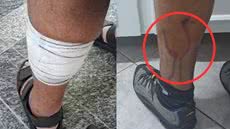 O ataque ocorreu em um local movimentado, levantando questões sobre a segurança de ciclistas e pedestres - Imagem: Reprodução