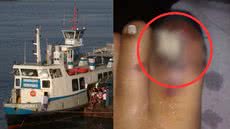 Falta de sinalização e cuidados resultaram em acidente - Imagem: Reprodução