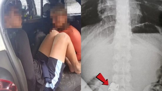 Após roubo na Praia das Pitangueiras, um dos suspeitos foi internado ao engolir as correntes de ouro para evitar a prisão - Foto: Reprodução