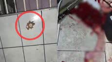 Jovem baleado foi socorrido, mas não resistiu aos ferimentos e faleceu na UPA - Imagem: Reprodução