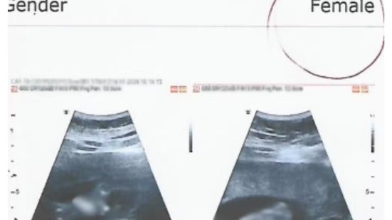 Defesa do médico afirma que ultrassom é para saúde do bebê e que erro pode ocorrer por fatores técnicos - Imagem: Reprodução