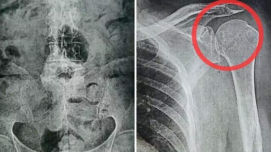 Indenização inclui gastos médicos; Justiça reforça proteção ao consumidor, especialmente os mais vulneráveis - Foto: Reprodução