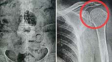 Indenização inclui gastos médicos; Justiça reforça proteção ao consumidor, especialmente os mais vulneráveis - Foto: Reprodução