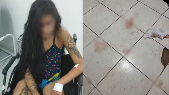 Apesar da brutalidade das agressões, a jovem recebeu alta médica - Imagem: Reprodução