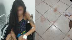 Apesar da brutalidade das agressões, a jovem recebeu alta médica - Imagem: Reprodução
