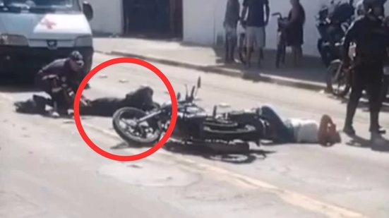Batida entre motos deixa vítima com fratura grave e mobiliza Samu em Guarujá