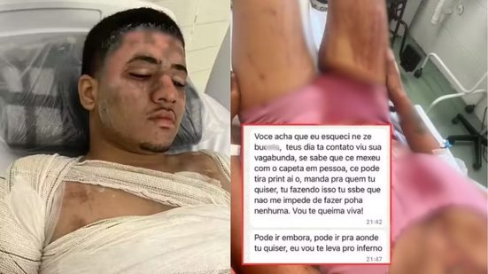Thalys Feitosa da Silva ameaçou a vítima por mensagens enquanto estava internado tratando queimaduras - Imagem: Reprodução