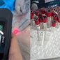 Investigadores apreenderam materiais cirúrgicos e medicamentos em consultório que imitava um hospital, sem segurança - Foto: Divulgação/ Polícia Civil