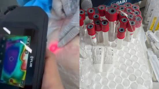 Investigadores apreenderam materiais cirúrgicos e medicamentos em consultório que imitava um hospital, sem segurança - Foto: Divulgação/ Polícia Civil