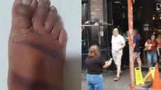 O juiz destacou a falha grave na sinalização e a negligência da empresa em garantir a segurança nas vias públicas - Imagem: Reprodução