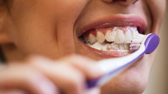Sorriso de filtro: os perigos das receitas caseiras e dos clareadores de internet - Imagem: Reprodução/Magnific
