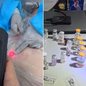 Materiais hospitalares, medicamentos e anestésicos foram apreendidos pela Polícia Civil em clínica clandestina que funcionava no bairro Embaré, em Santos. - Imagem: Reprodução e Polícia Civil