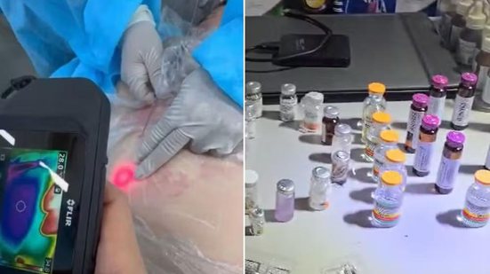 Materiais hospitalares, medicamentos e anestésicos foram apreendidos pela Polícia Civil em clínica clandestina que funcionava no bairro Embaré, em Santos. - Imagem: Reprodução e Polícia Civil