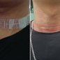 Pedro Henrique da Silva Vaz, de 19 anos, sofreu um corte no pescoço após ser atingido por uma linha de pipa enquanto pilotava uma motocicleta em Sete Barras - Imagem: Arquivo Pessoal