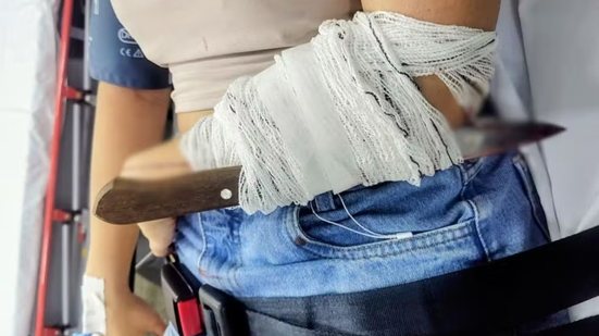 Jovem foi socorrida com faca cravada no braço após confusão em bar na região central de Santos - Imagem: g1 Santos