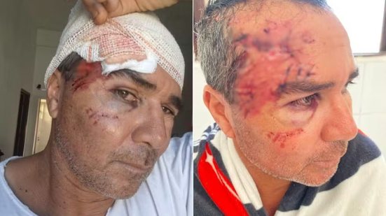 Embarcação virou durante pesca em Peruíbe; pescador ferido foi resgatado após se abrigar em ilha - Imagem: Arquivo Pessoal