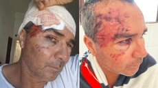 Embarcação virou durante pesca em Peruíbe; pescador ferido foi resgatado após se abrigar em ilha - Imagem: Arquivo Pessoal