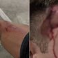 Guarda-vidas ficou ferido após cair da bicicleta ao tentar fugir de criminosos durante assalto em Guarujá - Imagem: Arquivo pessoal