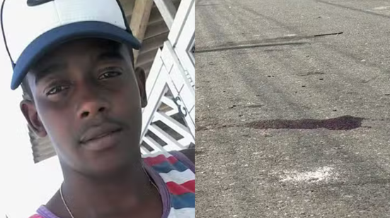 Jovem de 19 anos foi agredida com uma paulada na cabeça em Praia Grande; suspeito segue foragido - Imagem: Reprodução