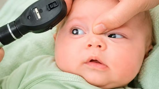 Entre os principais sinais da doença estão o reflexo branco na pupila, conhecido como “olho de gato”, estrabismo, dificuldade para enxergar, dor e vermelhidão nos olhos - Imagem: Divulgação/Hospital dos Olhos