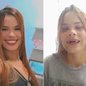 Gabriela Santana Gomes da Silva busca arrecadar recursos para realizar uma prótese dentária após perder cinco dentes em um acidente de motocicleta ocorrido em maio, em Praia Grande - Imagem: Reprodução/Redes sociais