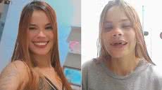 Gabriela Santana Gomes da Silva busca arrecadar recursos para realizar uma prótese dentária após perder cinco dentes em um acidente de motocicleta ocorrido em maio, em Praia Grande - Imagem: Reprodução/Redes sociais