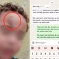 Mãe denuncia creche municipal de Praia Grande após filho de dois anos voltar para casa com hematoma no rosto. Família relata episódios anteriores de mordidas e cobra esclarecimentos sobre o ocorrido. - Arquivo Pessoal