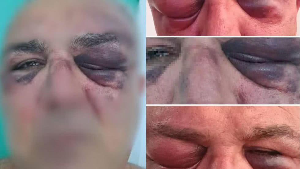 Vanderlei Alves Pinto Ribeiro foi agredido por um vizinho após pedir ajuda para ler encomendas no hall do prédio em Santos - Imagem: Arquivo Pessoal/ A Tribuna/ G1