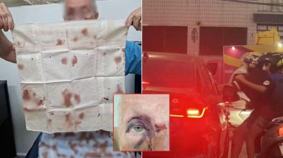 Idoso ficou ferido após ser agredido por motociclistas durante confusão no trânsito em Praia Grande - Imagem: Reprodução